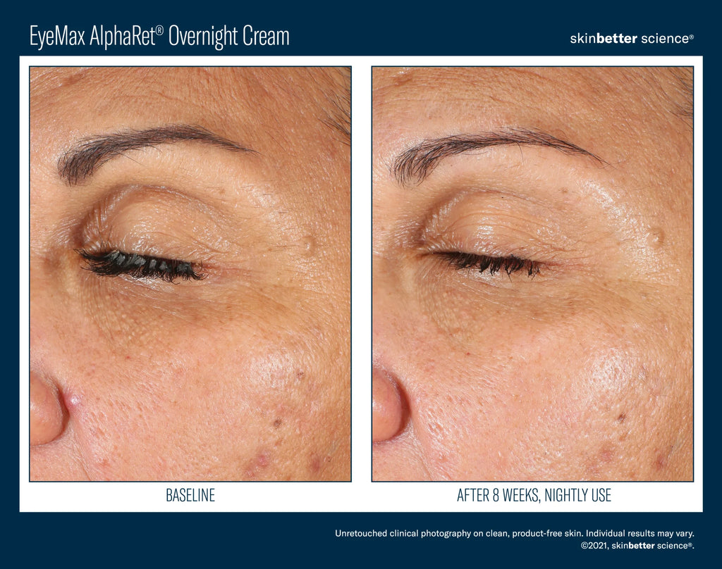 EyeMax AlphaRet Overnight Cream 15ml