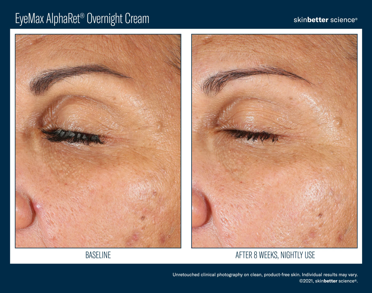 EyeMax AlphaRet Overnight Cream 15ml