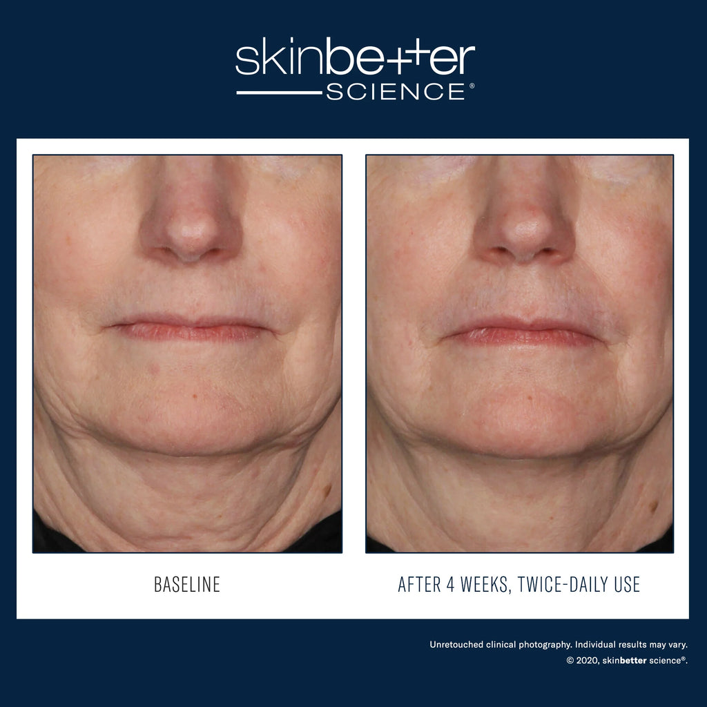 InterFuse Treatment Cream Face and Neck 30ml