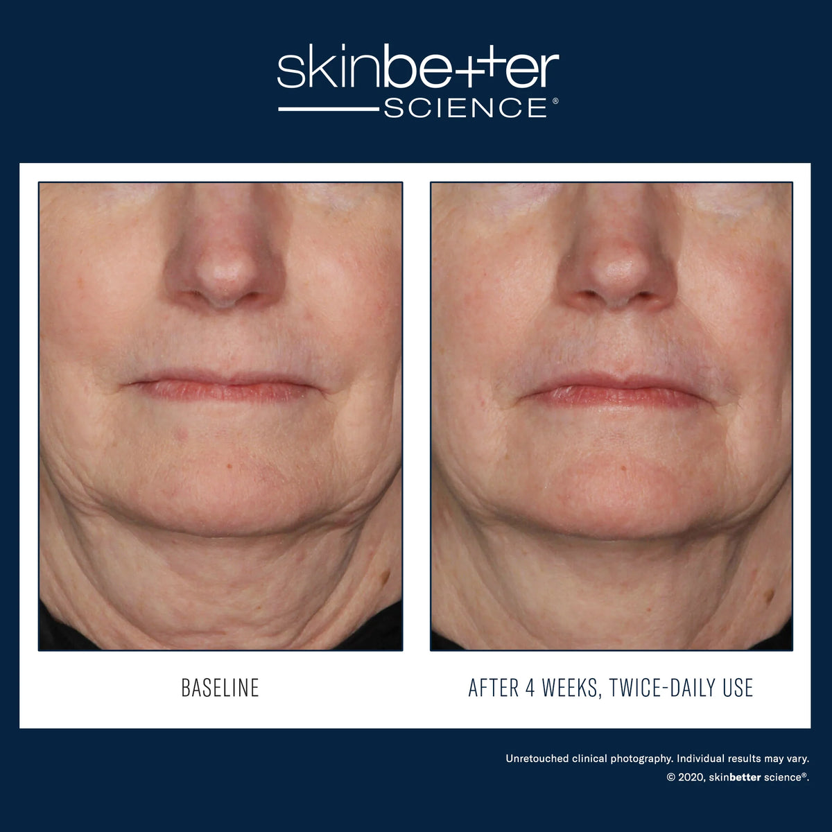 InterFuse Treatment Cream Face and Neck 30ml