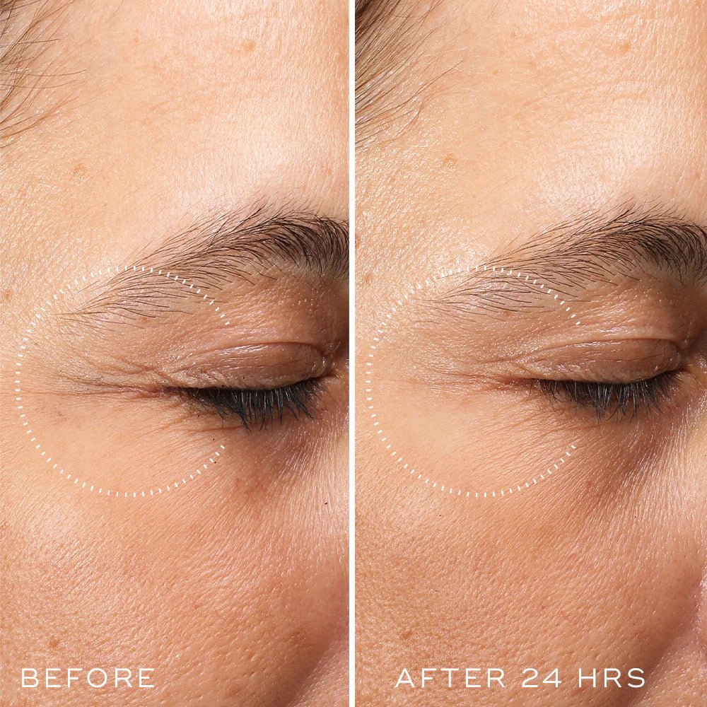 Medik8 Crystal Retinal Ceramide Eye 6 15ml